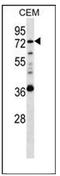 Heparanase 2 (Inactive) antibody, AP52095PU-N, Origene, Western Blot image 