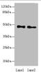 Abhydrolase Domain Containing 2 antibody, A57946-100, Epigentek, Western Blot image 