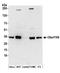 Inflammation And Lipid Regulator With UBA-Like And NBR1-Like Domains antibody, A304-602A, Bethyl Labs, Western Blot image 