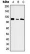 Solute Carrier Family 9 Member A5 antibody, LS-C353774, Lifespan Biosciences, Western Blot image 