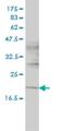 Iron-sulfur cluster assembly enzyme ISCU, mitochondrial antibody, H00023479-M01, Novus Biologicals, Western Blot image 