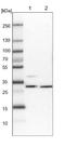 Zinc Finger C2HC-Type Containing 1A antibody, NBP1-88246, Novus Biologicals, Western Blot image 