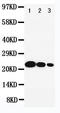 IL-6 antibody, LS-C312861, Lifespan Biosciences, Western Blot image 