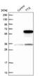 TELO2 Interacting Protein 2 antibody, NBP1-82085, Novus Biologicals, Western Blot image 