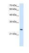 Phosphopantothenoylcysteine Decarboxylase antibody, NBP1-56489, Novus Biologicals, Western Blot image 