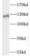 Solute Carrier Family 4 Member 8 antibody, FNab07968, FineTest, Western Blot image 
