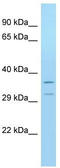 Olfactory Receptor Family 3 Subfamily A Member 1 antibody, TA332125, Origene, Western Blot image 
