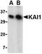 CD82 Molecule antibody, orb74815, Biorbyt, Western Blot image 