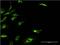 Ketohexokinase antibody, MA5-19238, Invitrogen Antibodies, Immunofluorescence image 
