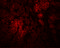 Coiled-coil domain-containing protein 106 antibody, 5865, ProSci, Immunofluorescence image 