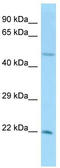 Ubiquitin Conjugating Enzyme E2 H antibody, TA329561, Origene, Western Blot image 
