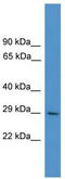 Zinc Finger Protein 688 antibody, TA341462, Origene, Western Blot image 