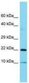 Coatomer Protein Complex Subunit Zeta 1 antibody, TA335569, Origene, Western Blot image 