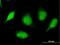 SplA/Ryanodine Receptor Domain And SOCS Box Containing 3 antibody, H00090864-B01P, Novus Biologicals, Immunofluorescence image 
