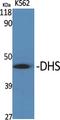 Deoxyhypusine Synthase antibody, A02106, Boster Biological Technology, Western Blot image 