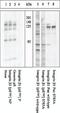 Integrin Subunit Beta 1 antibody, 44-870G, Invitrogen Antibodies, Western Blot image 