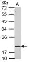 Ring Finger Protein 5 antibody, NBP2-20192, Novus Biologicals, Western Blot image 