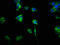 Colony Stimulating Factor 2 Receptor Alpha Subunit antibody, LS-C369450, Lifespan Biosciences, Immunofluorescence image 