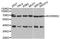 KH domain-containing, RNA-binding, signal transduction-associated protein 2 antibody, abx007227, Abbexa, Western Blot image 
