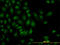 SMAD Family Member 1 antibody, LS-C133298, Lifespan Biosciences, Immunofluorescence image 