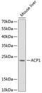 Acid Phosphatase antibody, GTX64697, GeneTex, Western Blot image 