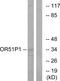 Olfactory Receptor Family 51 Subfamily D Member 1 antibody, GTX87396, GeneTex, Western Blot image 