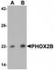 Paired Like Homeobox 2B antibody, TA319764, Origene, Western Blot image 