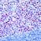 BCL6 Transcription Repressor antibody, MA5-11493, Invitrogen Antibodies, Immunohistochemistry paraffin image 