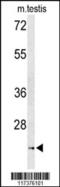 Protein unc-119 homolog A antibody, 63-914, ProSci, Western Blot image 