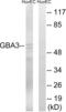 Glucosylceramidase Beta 3 (Gene/Pseudogene) antibody, abx014412, Abbexa, Western Blot image 