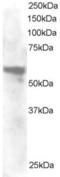 STE20 Related Adaptor Beta antibody, orb18453, Biorbyt, Western Blot image 
