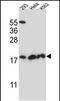 Dihydrofolate Reductase 2 antibody, PA5-48563, Invitrogen Antibodies, Western Blot image 