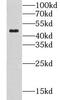 CLN3 Lysosomal/Endosomal Transmembrane Protein, Battenin antibody, FNab01767, FineTest, Western Blot image 