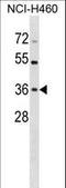 Checkpoint protein HUS1 antibody, LS-C165090, Lifespan Biosciences, Western Blot image 