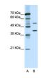REX4 Homolog, 3'-5' Exonuclease antibody, orb324441, Biorbyt, Western Blot image 