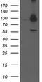 Proteasome 26S Subunit, Non-ATPase 2 antibody, CF503229, Origene, Western Blot image 