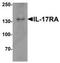 Interleukin 17 Receptor A antibody, TA319870, Origene, Western Blot image 