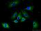 ATP/GTP Binding Protein 1 antibody, 14067-1-AP, Proteintech Group, Immunofluorescence image 