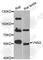Vanin 2 antibody, A8170, ABclonal Technology, Western Blot image 