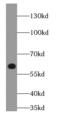Glutaminase antibody, FNab03290, FineTest, Western Blot image 