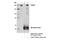 DNA Topoisomerase II Binding Protein 1 antibody, 14342S, Cell Signaling Technology, Immunoprecipitation image 