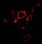 Snail Family Transcriptional Repressor 2 antibody, GTX30813, GeneTex, Immunohistochemistry paraffin image 