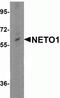 Neuropilin And Tolloid Like 1 antibody, NBP2-41134, Novus Biologicals, Western Blot image 