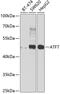 Cyclic AMP-dependent transcription factor ATF-7 antibody, 23-040, ProSci, Western Blot image 