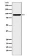 Aldehyde Dehydrogenase 1 Family Member L1 antibody, M04615-5, Boster Biological Technology, Western Blot image 