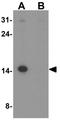 Nucleosome Assembly Protein 1 Like 5 antibody, GTX32154, GeneTex, Western Blot image 