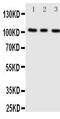 ADAM Metallopeptidase With Thrombospondin Type 1 Motif 1 antibody, GTX12304, GeneTex, Western Blot image 