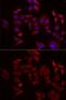 Nephrocystin-1 antibody, GTX65891, GeneTex, Immunofluorescence image 
