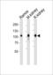 Membrane Metalloendopeptidase antibody, LS-B11799, Lifespan Biosciences, Western Blot image 