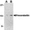 Cerebellin 1 Precursor antibody, MBS150458, MyBioSource, Western Blot image 